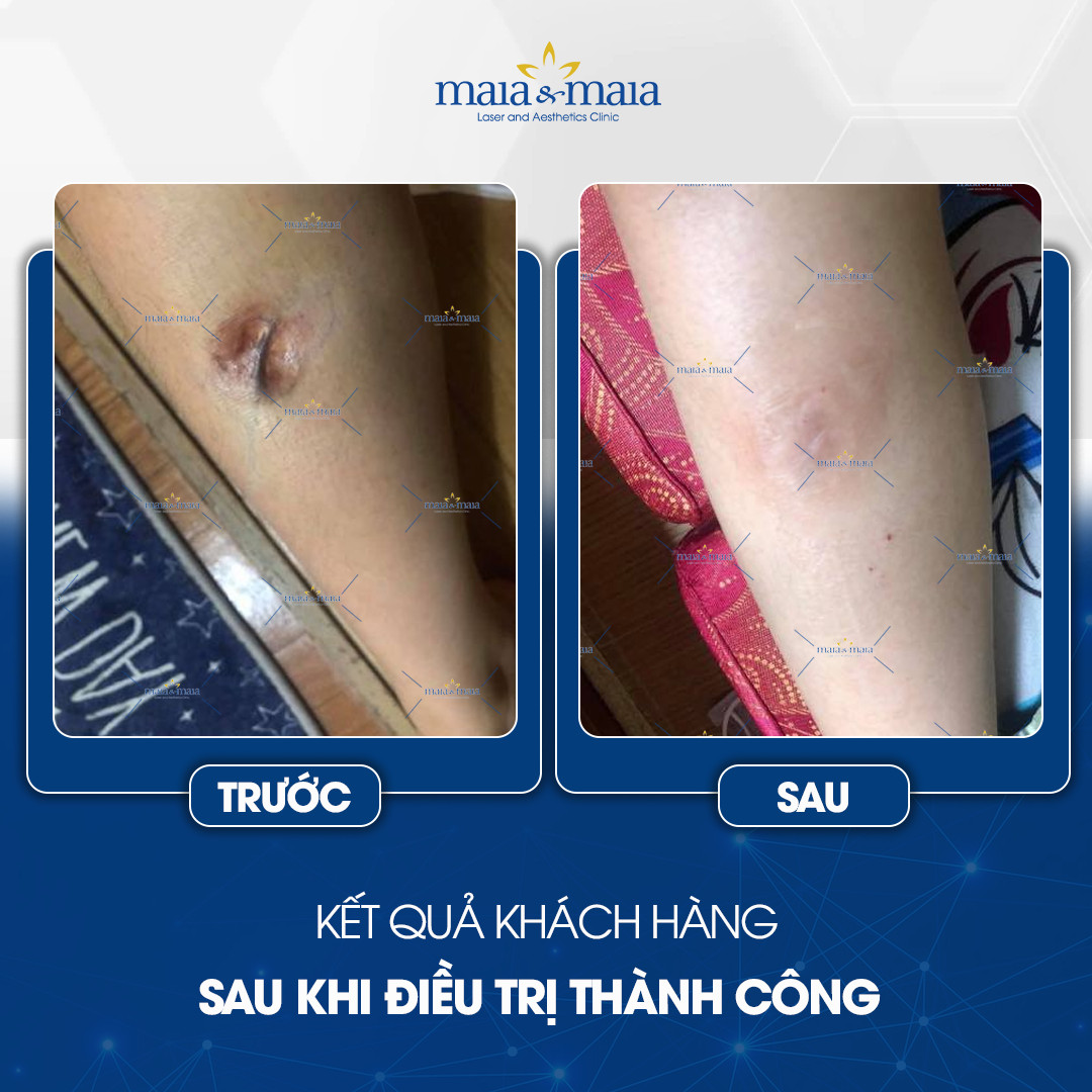 phuong-phap-dieu-tri-seo-7
