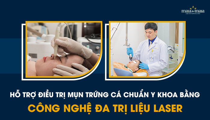 ho-tro-dieu-tri-mun-trung-ca-1