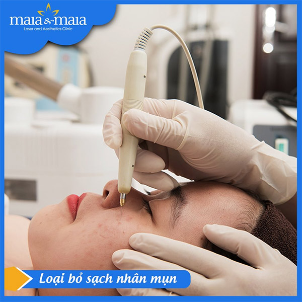 Công nghệ Laser Diot loại bỏ sạch nhân mụn Công nghệ Laser Diot loại bỏ sạch nhân mụn