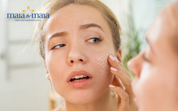 Da khô cần được cung cấp đủ ẩm Da khô cần được cung cấp đủ ẩm