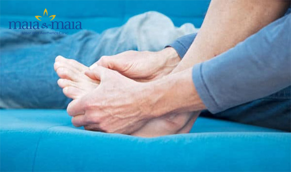 Bệnh tổ đỉa ở chân gây khó khăn cho việc đi lại Bệnh tổ đỉa ở chân gây khó khăn cho việc đi lại