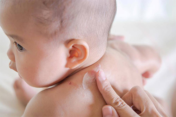 Bôi kem dưỡng ẩm cho trẻ Bôi kem dưỡng ẩm cho trẻ