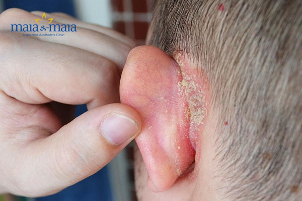 Nên cho con đi thăm khám bác sĩ càng sớm càng tốt Nên cho con đi thăm khám bác sĩ càng sớm càng tốt