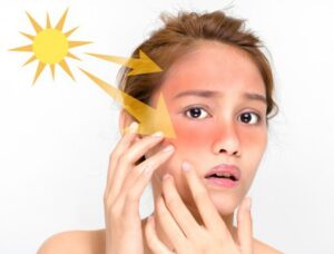 Không dùng kem chống nắng sau khi sử dụng AHA, BHA