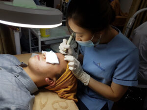 Sử dụng công nghệ Laser Diot trong điều trị mụn