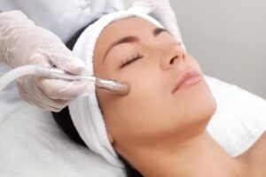 Phương pháp microdermabrasion - mài da vi điểm