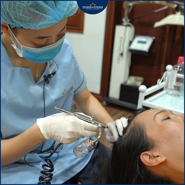 Sử dụng công nghệ cao trong hỗ trợ điều trị rụng tóc