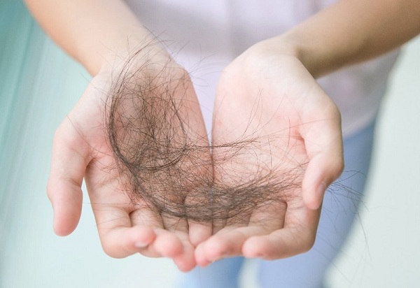 Nếu thấy lượng tóc rụng nhiều hơn bình thường, hãy đi khám ngay