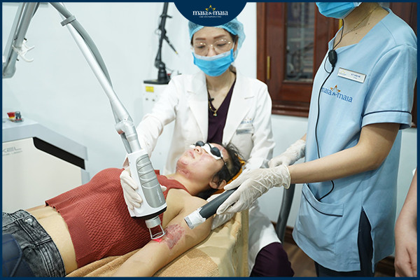 Sử dụng laser trong điều trị sẹo lồi