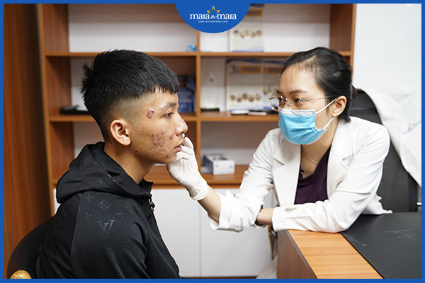 Bạn nên thăm khám với bác sĩ da liễu để được kê đơn thuốc phù hợp