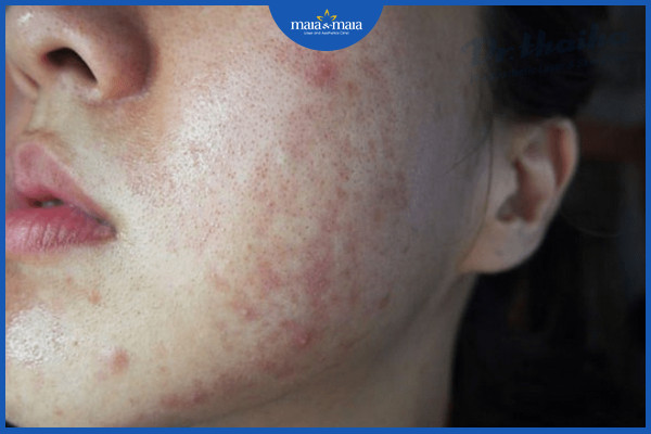 Không nên sử dụng những sản phẩm có tác dụng cấp tốc