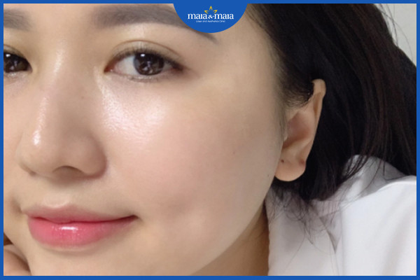 Sở hữu một làn da trẻ trung là mục tiêu mà tất cả mọi người đều mong muốn