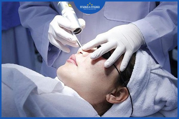 Cách trị sẹo lồi mới hình thành