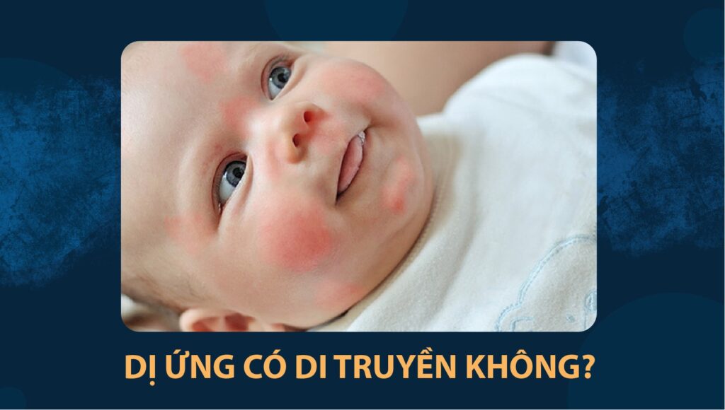 dị ứng có di truyền không