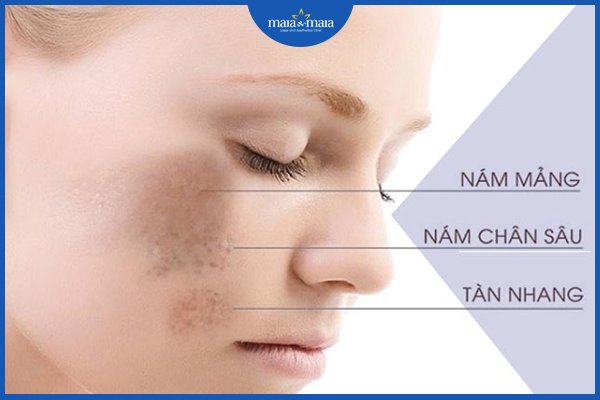 nám nội tiết