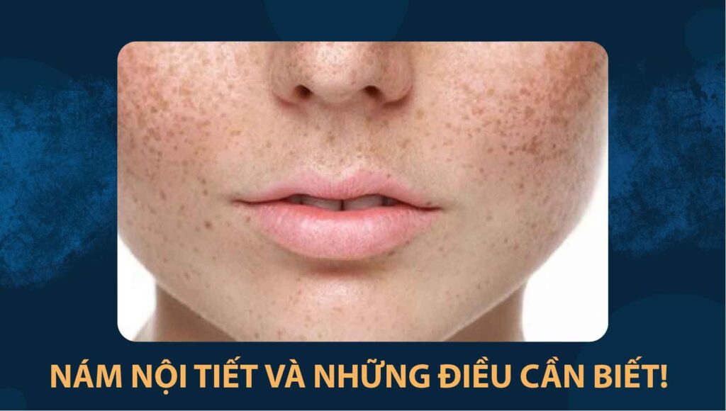 nám nội tiết