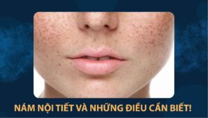 nám nội tiết