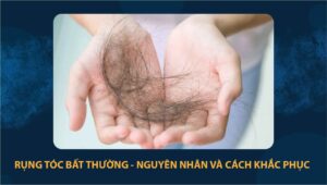 rụng tóc bất thường