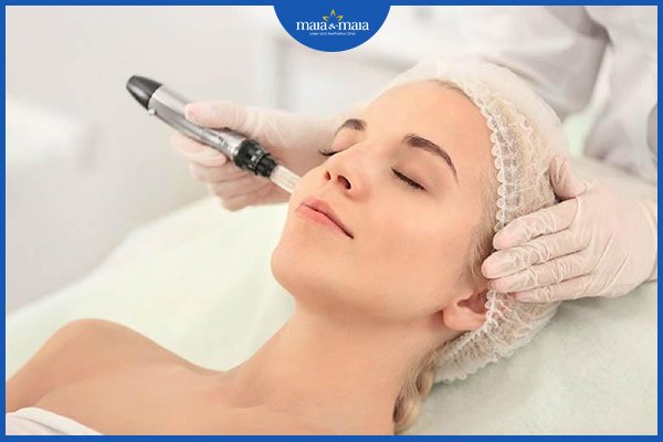 trị sẹo bằng laser