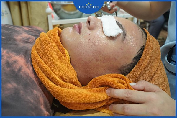 Tuỳ vào tình trạng của mỗi người mà có phương pháp điều trị sẹo thâm phù hợp