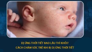 Dị ứng thời tiết bao lâu thì khỏi