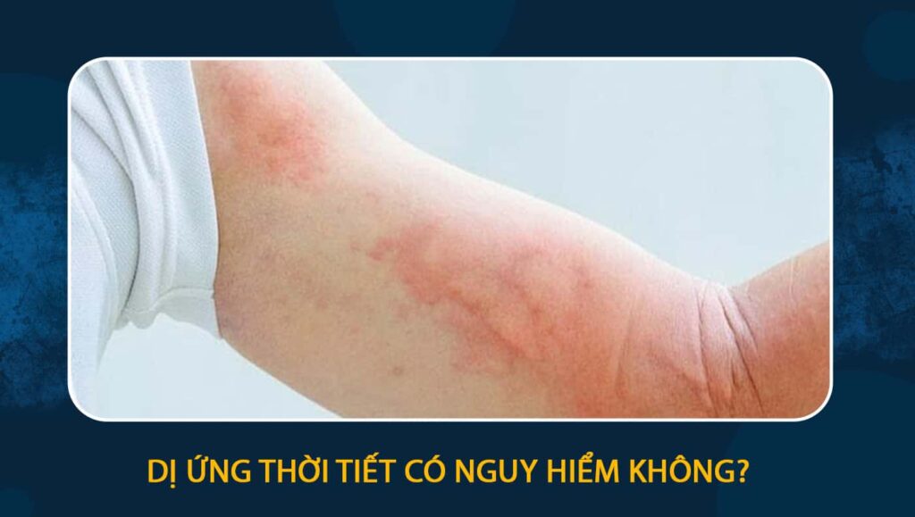 dị ứng thời tiết có nguy hiểm không