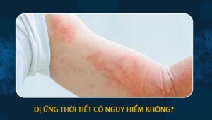 dị ứng thời tiết có nguy hiểm không