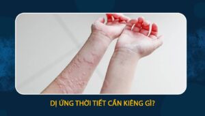 dị ứng thời tiết kiêng gì