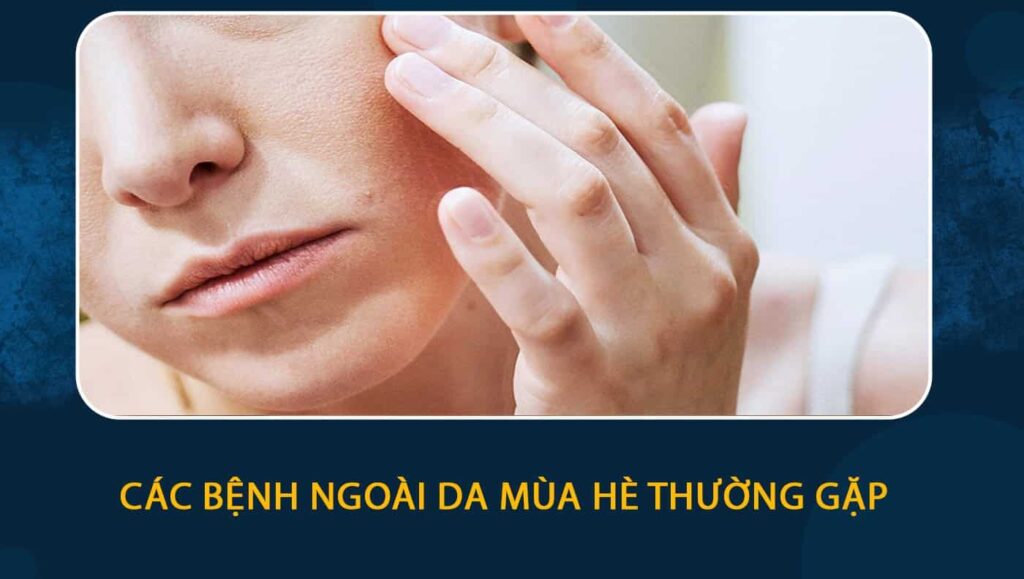 bệnh ngoài da mùa hè