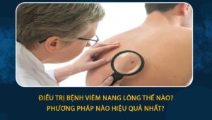 điều trị bệnh viêm nang lông