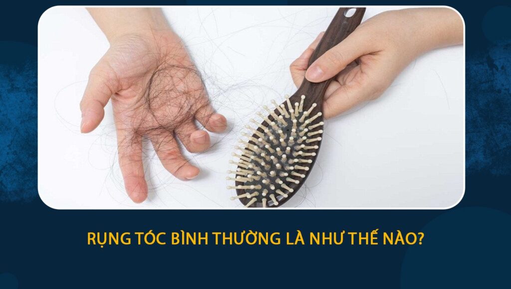 rụng tóc bình thường