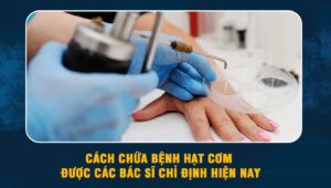 Cách chữa bệnh hạt cơm