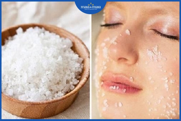 lưu ý khi tẩy nốt ruồi
