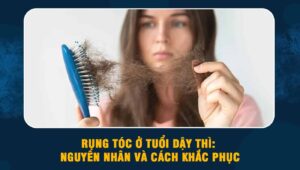 rụng tóc ở tuổi dậy thì
