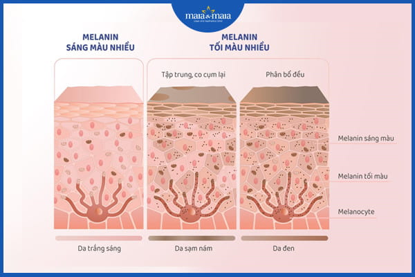 tàn nhang tuổi dậy thì