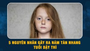 tàn nhang tuổi dậy thì