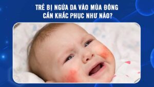 trẻ bị ngứa da vào mùa đông