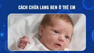 Cách chữa lang ben ở trẻ em