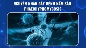 nguyên nhân gây bệnh nấm sâu