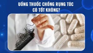 uống thuốc chống rụng tóc có tốt không