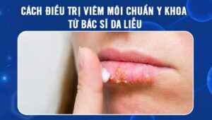 điều trị viêm môi