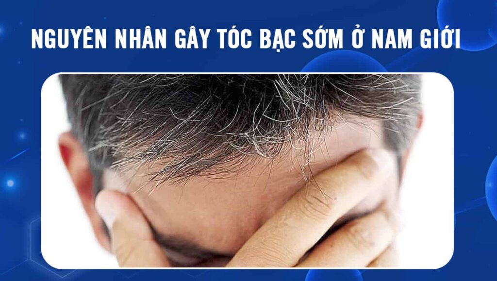 tóc bạc sớm ở nam giới