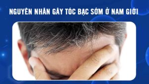 tóc bạc sớm ở nam giới