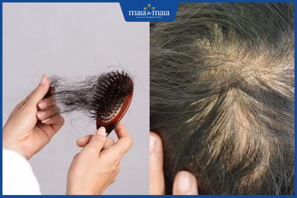 vấn đề thường gặp ở tóc