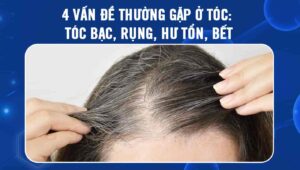 vấn đề thường gặp ở tóc