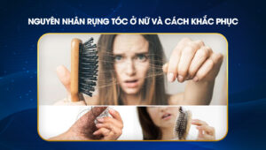 nguyen-nhan-rung-toc-o-nu