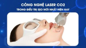 cong-nghe-laser-co2-trong-dieu-tri-seo-1