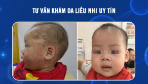 tu-van-kham-da-lieu-nhi-uy-tin-1