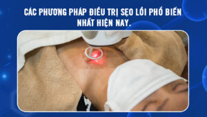 phuong-phap-dieu-tri-seo-1