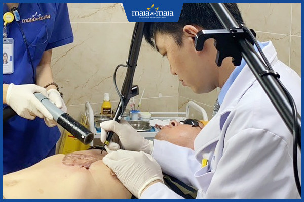 phuong-phap-dieu-tri-seo-15